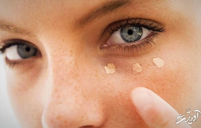 کرم دور چشم